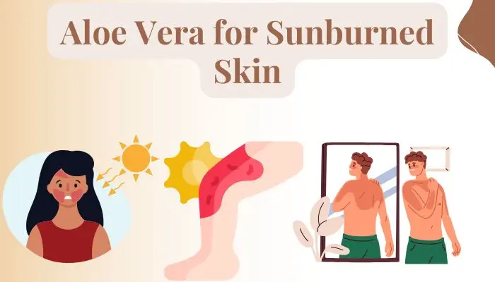 Aloe Vera For Sunburned Skin